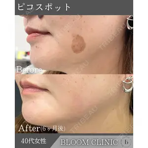 ブルームクリニック（BLOOM CLINIC）の症例