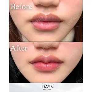 Days Beauty Clinic 新宿院の症例