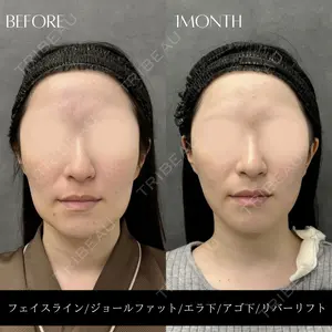 RIVER CLINIC（リバークリニック）大阪院の症例