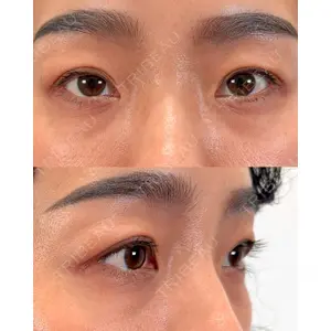 Moon Beauty Clinic 渡邉 正士医師の症例