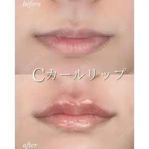 ルラ美容クリニック 札幌大通り院 能登 貴弘医師の症例