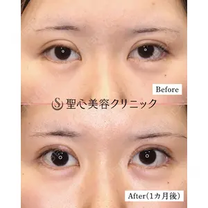 聖心美容クリニック 六本木院 星野 善允医師の症例