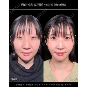 東京シンデレラ美容外科 大宮院 竹田 昌平医師の症例