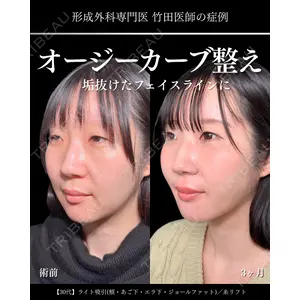 東京シンデレラ美容外科 大宮院 竹田 昌平医師の症例