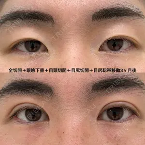 エターナル美容クリニック 久門田 詳医師の症例