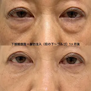 エターナル美容クリニック 久門田 詳医師の症例