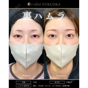 eクリニック 福岡院の症例