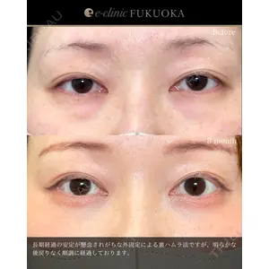 eクリニック 福岡院の症例
