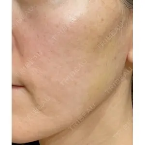 アデル美容クリニック 青柳 慶憲医師の症例