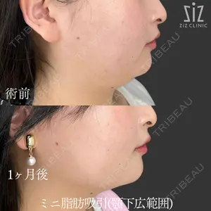 ziz CLINIC 村岡 史子医師の症例