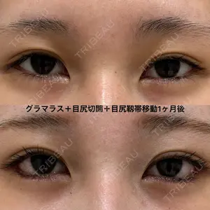 エターナル美容クリニック 久門田 詳医師の症例