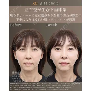 gift clinic 能登谷 翔医師の症例