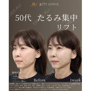 gift clinic 能登谷 翔医師の症例