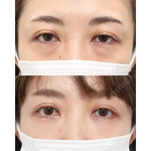gift clinic 能登谷 翔医師の症例