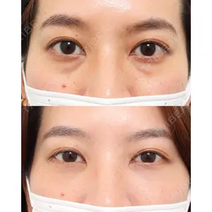 gift clinic 能登谷 翔医師の症例