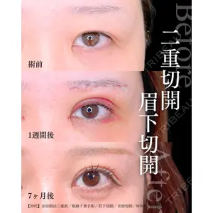 東京シンデレラ美容外科 大宮院 竹田 昌平医師の症例