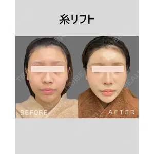 CHARIS BEAUTY CLINIC 宮内　孝維医師の症例