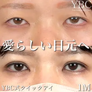 YBC横浜美容外科 池袋院 磯村 亮輔医師の症例