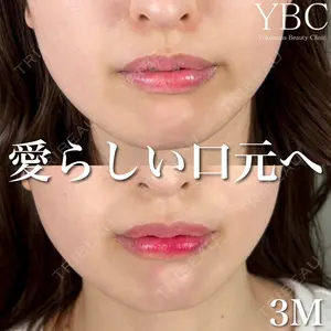 YBC横浜美容外科 池袋院 磯村 亮輔医師の症例