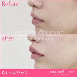 フィラークリニック 新宿院の症例