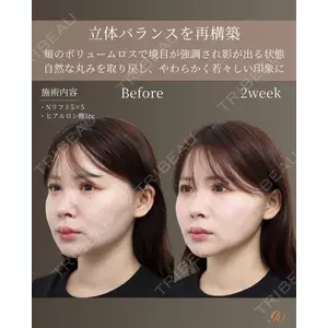 gift clinic 能登谷 翔医師の症例