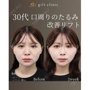 gift clinic 能登谷 翔医師の症例