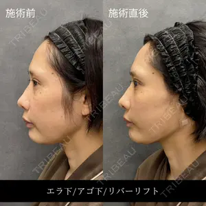 RIVER CLINIC（リバークリニック）大阪院の症例