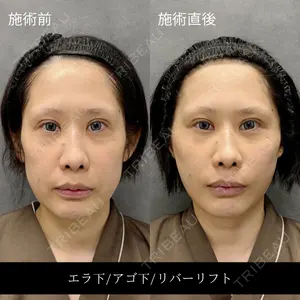 RIVER CLINIC（リバークリニック）大阪院の症例