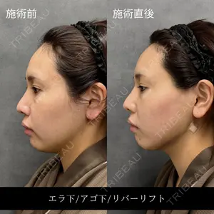 RIVER CLINIC（リバークリニック）大阪院の症例