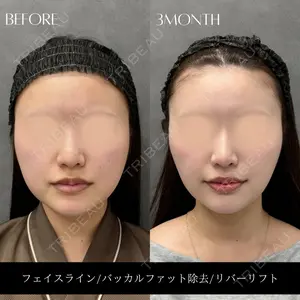 RIVER CLINIC（リバークリニック）大阪院の症例