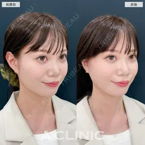 A CLINIC（エークリニック） 新宿院 瀬戸　翔太医師の症例