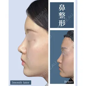 eクリニック 横浜みなとみらい院 坂本 優衣医師の症例