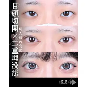 東京シンデレラ美容外科 池袋院 石井 達也医師の症例