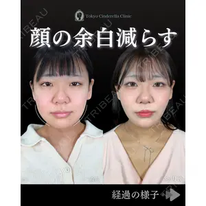 東京シンデレラ美容外科 池袋院 石井 達也医師の症例