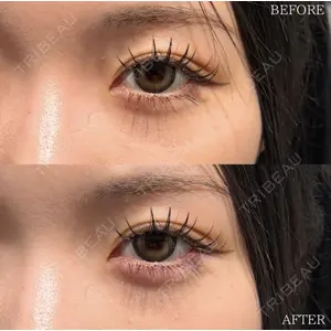 X CLINIC 恵比寿院 辻村 梢医師の症例