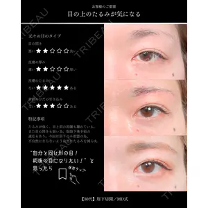 東京シンデレラ美容外科 大宮院 竹田 昌平医師の症例