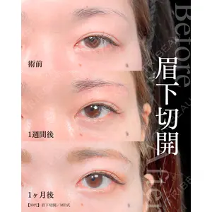 東京シンデレラ美容外科 大宮院 竹田 昌平医師の症例