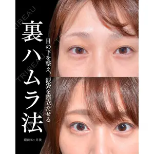 東京シンデレラ美容外科 大宮院 竹田 昌平医師の症例