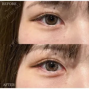 X CLINIC 恵比寿院 辻村 梢医師の症例