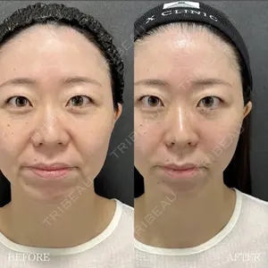 X CLINIC 恵比寿院 辻村 梢医師の症例