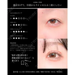 東京シンデレラ美容外科 大宮院 竹田 昌平医師の症例