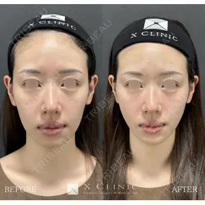 X CLINIC 恵比寿院 辻村 梢医師の症例