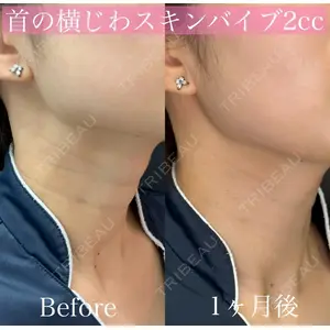 ルラ美容クリニック 渋谷本院 昼間 路子医師の症例