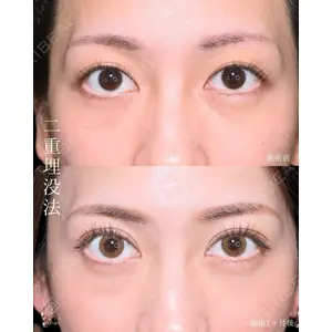 藤・ナチュレ美容クリニック 銀座院 小川 杏平医師の症例