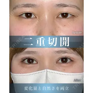 eクリニック 横浜みなとみらい院 坂本 優衣医師の症例