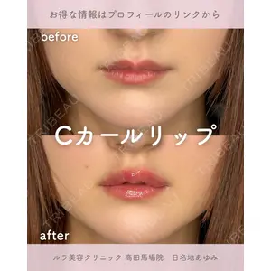 ルラ美容クリニック 高田馬場院 日名地 あゆみ医師の症例