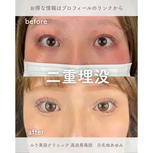 ルラ美容クリニック 高田馬場院 日名地 あゆみ医師の症例