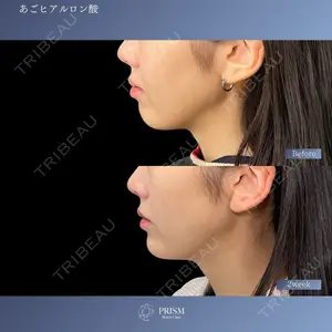 PRISM Beauty Clinic 新宿院 畑山 知輝医師の症例