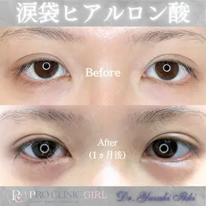 PRO CLINIC プロクリニック 銀座院 柚﨑 一輝医師の症例