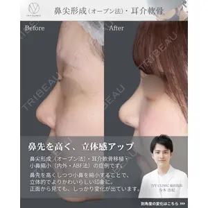 千葉美容外科アイビークリニックの症例